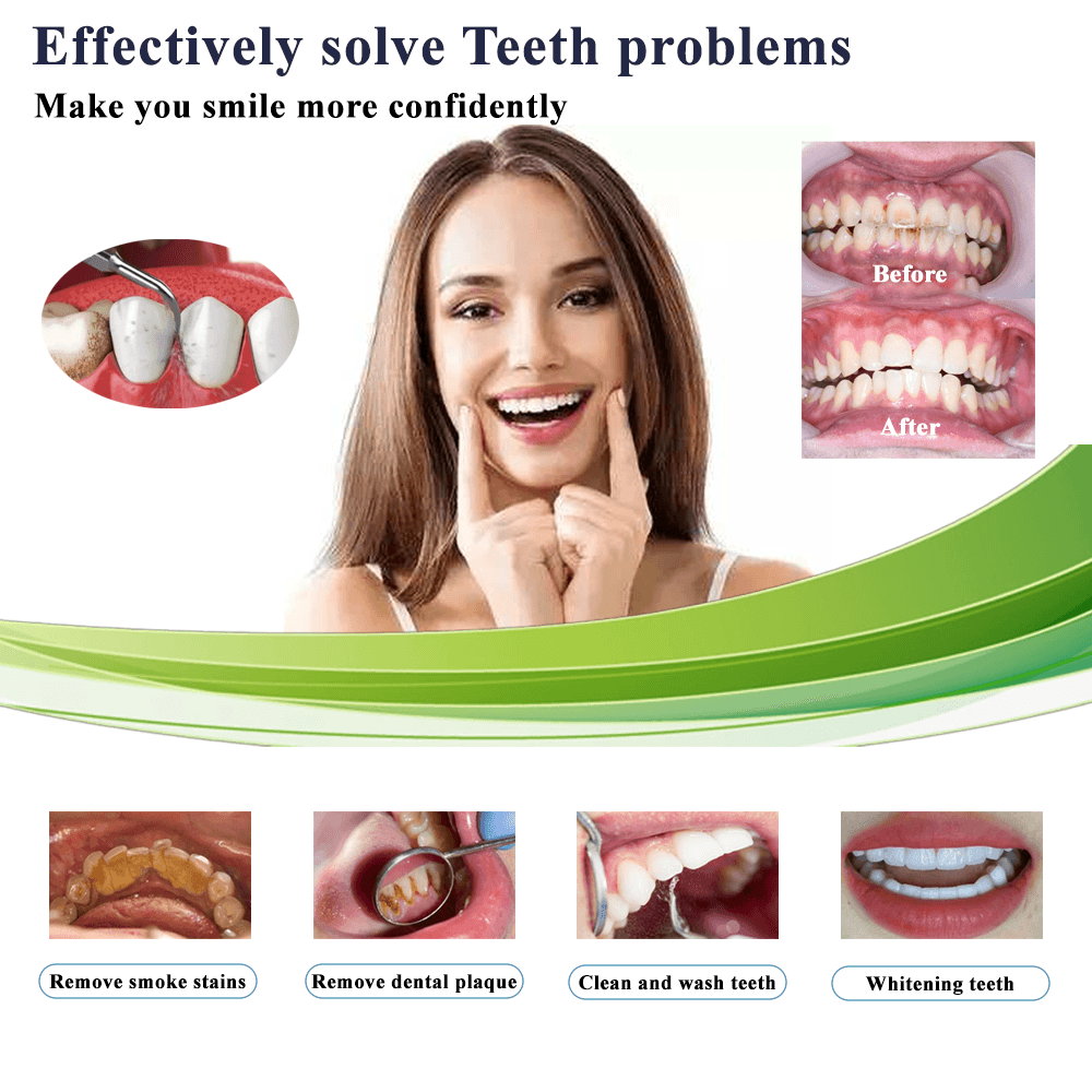 Máquina dental 5 en 1 - ¡Bienvenido a diente-dental.com! Máquina dental 5 en 1